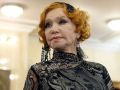 Неудачная пластика Веры Алентовой: история борьбы и преодоления